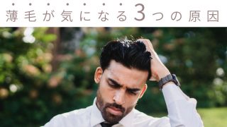 【もう大丈夫】ハゲを気にしないで良くなる、3つの薄毛隠し